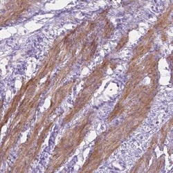 MBLAC1 Antibody, Novus Biologicals 25 &mu;L, Unconjugated:Antibodies, Polyclonal