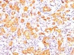 MUC1 Antibody (GP1.4) - IHC-Prediluted, Novus Biologicals 7 mL, Unconjugated:Antibodies,