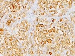 Melan-A/MART-1 Antibody (M2-9E3) - IHC-Prediluted, Novus Biologicals 7