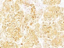 Melan-A/MART-1 Antibody (M2-9E3) - IHC-Prediluted, Novus Biologicals 7