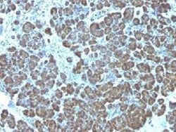 Mitochondria Antibody (113-1) - IHC-Prediluted, Novus Biologicals 7 mL,