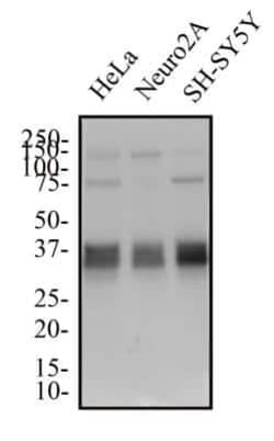 Musashi-2 Antibody - BSA Free, Novus Biologicals 0.1 mg | Buy Online | Novus Biologicals | Fisher Scientific