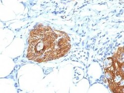 NCAM-1/CD56 Antibody (123A8 (same as 56C04)) - IHC-Prediluted, Novus Biologicals