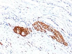 NCAM-1/CD56 Antibody (123C3.D5 + 123A8) - IHC-Prediluted, Novus Biologicals