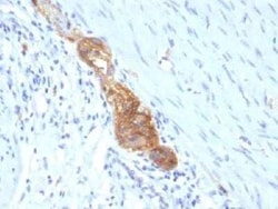 NCAM-1/CD56 Antibody (SPM489) - IHC-Prediluted, Novus Biologicals 7 mL,