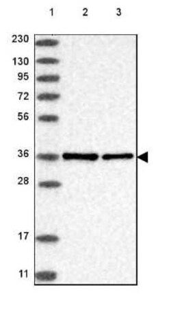 NIFK Antibody, Novus Biologicals 0.1 mL | Buy Online | Novus Biologicals | Fisher Scientific