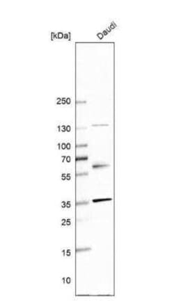 NTB-A/SLAMF6/CD352 Antibody, Novus Biologicals 0.1 mL | Buy Online | Novus Biologicals | Fisher Scientific