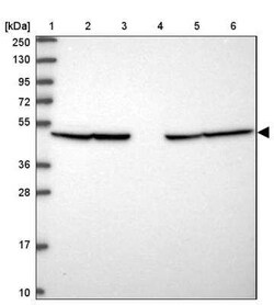 PBEF/Visfatin/NAMPT Antibody, Novus Biologicals 0.1 mL, Unconjugated:Antibodies