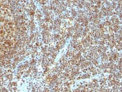 PCNA Antibody (SPM350) - IHC-Prediluted, Novus Biologicals 7 mL, Unconjugated:Antibodies,