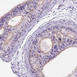 PEX12 Antibody, Novus Biologicals 25 &mu;L, Unconjugated:Antibodies, Polyclonal