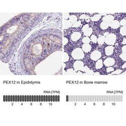 PEX12 Antibody, Novus Biologicals 25 &mu;L, Unconjugated:Antibodies, Polyclonal