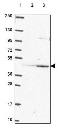 PEX12 Antibody, Novus Biologicals 25 &mu;L, Unconjugated:Antibodies, Polyclonal