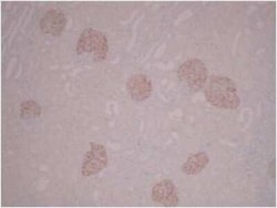 PLA2R1 Antibody (12-6-5) - BSA Free, Novus Biologicals 0.1 mL, Unconjugated:Antibodies,