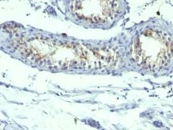 Prolactin R Antibody (B6.2 + PRLR742) - IHC-Prediluted, Novus Biologicals