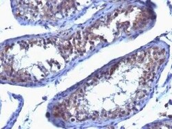 Prolactin R Antibody (SPM213) - IHC-Prediluted, Novus Biologicals 7 mL,