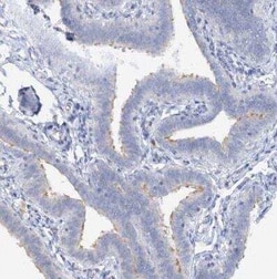 RFX6 Antibody, Novus Biologicals:Antibodies:Primary Antibodies