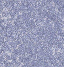 RFX6 Antibody, Novus Biologicals:Antibodies:Primary Antibodies