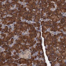 RGS11 Antibody, Novus Biologicals 25 &mu;L, Unconjugated:Antibodies, Polyclonal