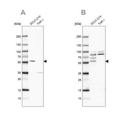 RIPX Antibody, Novus Biologicals 0.1 mL, Unconjugated:Antibodies, Polyclonal