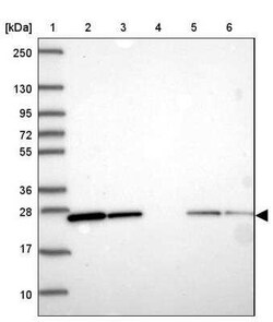 Rab1A Antibody, Novus Biologicals:Antibodies:Primary Antibodies