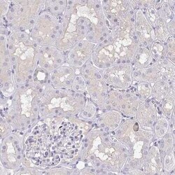 RhoV Antibody, Novus Biologicals 0.1 mL, Unconjugated:Antibodies, Polyclonal