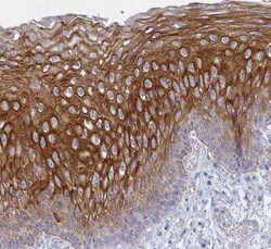 RhoV Antibody, Novus Biologicals 0.1 mL, Unconjugated:Antibodies, Polyclonal