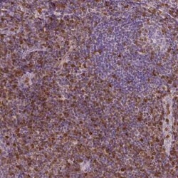 S100A4 Antibody (CL0239), Novus Biologicals 0.1 mL, Unconjugated:Antibodies,