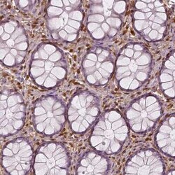 S100A4 Antibody (CL0239), Novus Biologicals 0.1 mL, Unconjugated:Antibodies,