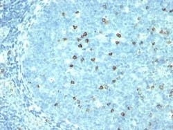 S100B Antibody (4C4.9) - IHC-Prediluted, Novus Biologicals 7 mL | Buy Online | Novus Biologicals | Fisher Scientific