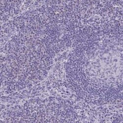 SLC36A2 Antibody, Novus Biologicals 0.1 mL, Unconjugated:Antibodies, Polyclonal