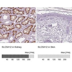 SLC5A12 Antibody, Novus Biologicals:Antibodies:Primary Antibodies