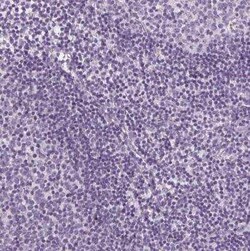 SLC5A12 Antibody, Novus Biologicals:Antibodies:Primary Antibodies