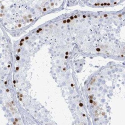SSX2 Antibody, Novus Biologicals 25 &mu;L, Unconjugated:Antibodies, Polyclonal