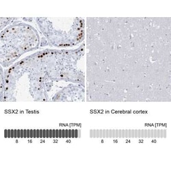 SSX2 Antibody, Novus Biologicals 25 &mu;L, Unconjugated:Antibodies, Polyclonal