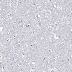 SSX2 Antibody, Novus Biologicals 25 &mu;L, Unconjugated:Antibodies, Polyclonal
