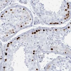 SSX2 Antibody, Novus Biologicals 25 &mu;L, Unconjugated:Antibodies, Polyclonal