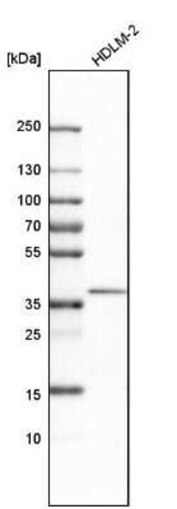 STING/TMEM173 Antibody, Novus Biologicals 0.1 mL, Unconjugated:Antibodies,