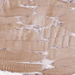 STRN4 Antibody, Novus Biologicals 25 &mu;L, Unconjugated:Antibodies, Polyclonal