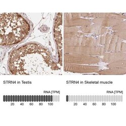 STRN4 Antibody, Novus Biologicals 25 &mu;L, Unconjugated:Antibodies, Polyclonal