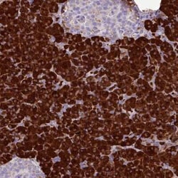 Salivary Amylase Alpha Antibody, Novus Biologicals 0.1 mL, Unconjugated:Antibodies,