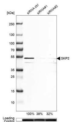 Skp2 Antibody, Novus Biologicals:Antibodies:Primary Antibodies