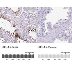Soggy-1/DkkL1 Antibody, Novus Biologicals 0.1 mL, Unconjugated:Antibodies,