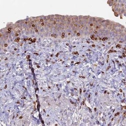 TARSH Antibody, Novus Biologicals 25 &mu;L, Unconjugated:Antibodies, Polyclonal