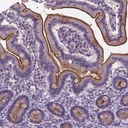 TM4SF20 Antibody, Novus Biologicals:Antibodies:Primary Antibodies