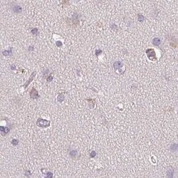 TREH Antibody, Novus Biologicals 0.1 mL, Unconjugated:Anticuerpos