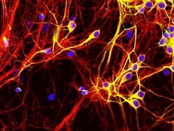 Tau Antibody (5B10), Novus Biologicals:Antibodies:Primary Antibodies
