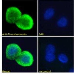 Thrombospondin-1 Antibody, Novus Biologicals 0.1 mg, Unconjugated:Antibodies,