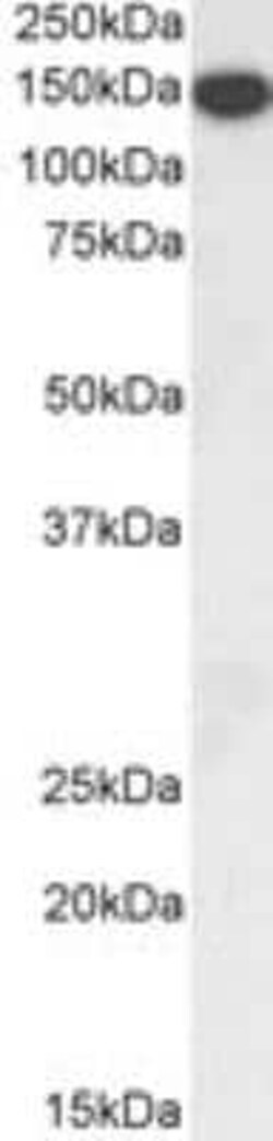 Thrombospondin-1 Antibody, Novus Biologicals 0.1 mg, Unconjugated:Antibodies,