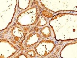 Thyroglobulin Antibody (6E1) - IHC-Prediluted, Novus Biologicals 7 mL,