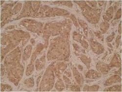 UCP1 Antibody (Vab12 P4B12 A12) - BSA Free, Novus Biologicals:Antibodies:Primary